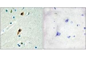 Immunohistochemistry analysis of paraffin-embedded human brain tissue, using RBM5 Antibody.