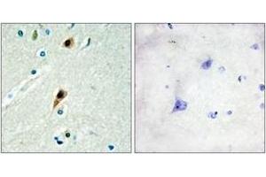 Immunohistochemistry analysis of paraffin-embedded human brain tissue, using RBM5 Antibody. (RBM5 anticorps  (AA 226-275))
