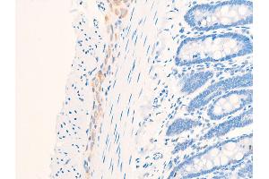 ABIN6267268 at 1/100 staining rat intestinal tissue sections by IHC-P. (EGFR anticorps  (pSer1026))