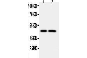 Anti-Caspase-2 antibody, Western blotting Lane 1: CEM Cell Lysate Lane 2: SMMC Cell Lysate (Caspase 2 anticorps  (C-Term))