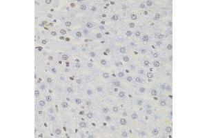 Immunohistochemistry of paraffin-embedded rat liver using AKAP8 antibody. (AKAP8 anticorps)