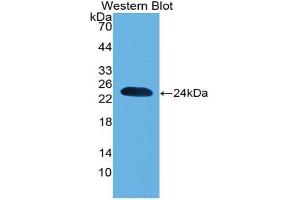 Detection of Recombinant PARK7, Mouse using Polyclonal Antibody to Parkinson Disease Protein 7 (PARK7)