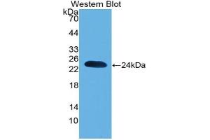 Detection of Recombinant PARK7, Mouse using Polyclonal Antibody to Parkinson Disease Protein 7 (PARK7) (PARK7/DJ1 anticorps  (AA 1-189))