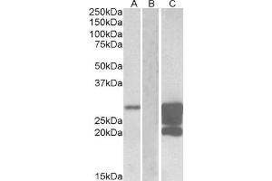 HEK293 lysate (10ug protein in RIPA buffer) overexpressing Human GM2A with DYKDDDDK tag probed with ABIN2562857 (1. (GM2A anticorps  (AA 179-189))