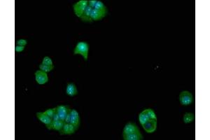 Immunofluorescence staining of MCF-7 cells with ABIN7152390 at 1:100, counter-stained with DAPI. (FCHO1 anticorps  (AA 45-180))