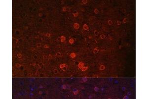 Immunofluorescence analysis of Mouse brain using TRPM2 Polyclonal Antibody at dilution of 1:100.