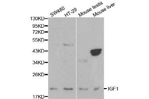 Western blot analysis of extracts of various cell lines, using IGF1 antibody. (IGF1 anticorps  (C-Term))