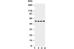 Western blot testing of Glut5 antbody;  Lane 1: U87;  2: 293T;  3: HT1080;  4: SW620 cell lysate