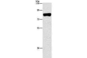 Western Blot analysis of Hela cell using ARHGAP25 Polyclonal Antibody at dilution of 1:500 (ARHGAP25 anticorps)