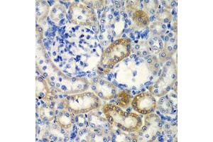 Immunohistochemistry of paraffin-embedded rat kidney using DCTD antibody  at dilution of 1:200 (40x lens). (DCMP Deaminase (DCTD) (AA 1-178) anticorps)