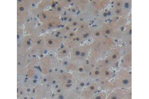 Used in DAB staining on fromalin fixed paraffin- embedded liver tissue (PANK1 anticorps  (AA 298-500))