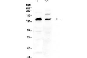 Western blot analysis of NEDD4 using anti-NEDD4 antibody . (NEDD4 anticorps  (AA 960-1245))