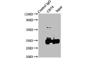 Immunoprecipitating CD74 in Raji whole cell lysate Lane 1: Rabbit control IgG instead of ABIN7155575 in Raji whole cell lysate.