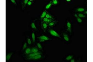 Immunofluorescence staining of Hela cells with ABIN7150342 at 1:166, counter-stained with DAPI. (Topoisomerase I anticorps  (AA 358-501))