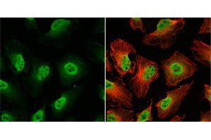 ICC/IF Image O-GlcNAc transferase antibody detects O-GlcNAc transferase protein at nucleus by immunofluorescent analysis.