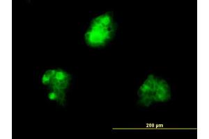 Immunofluorescence of monoclonal antibody to KHDRBS1 on A-431 cell. (KHDRBS1 anticorps  (AA 176-275))