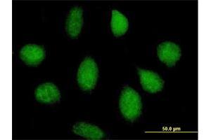 Immunofluorescence of purified MaxPab antibody to KIAA0157 on HeLa cell. (FAM175B anticorps  (AA 1-311))