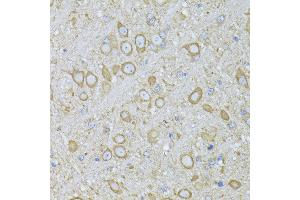 Immunohistochemistry of paraffin-embedded Mouse brain using MTNR1A antibody (ABIN6128254, ABIN6144165, ABIN6144166 and ABIN6216865) at dilution of 1:100 (40x lens). (Melatonin Receptor 1A anticorps  (AA 281-350))