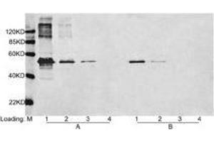 Loading: Lane 1-3 Multiple Tag (Purified) (ABIN1536315, 400 ng, 80 ng,16 ng) Lane 4. (DYKDDDDK Tag anticorps)