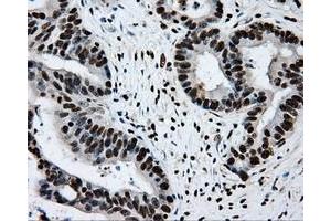 anti-Replication Protein A2, 32kDa (RPA2) antibody