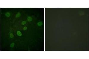 Immunofluorescence analysis of HuvEc cells treated with serum 20% 30', using DNA-PK (Phospho-Thr2638) Antibody.