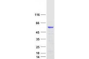 Validation with Western Blot