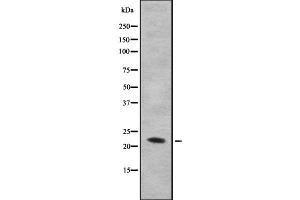 Western blot analysis IL28B using HuvEc whole cell lysates (IL28B anticorps)