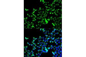 Immunofluorescence analysis of A549 cell using CALR antibody. (Calreticulin anticorps)