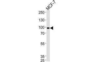Western Blotting (WB) image for anti-Collagen, Type IX, alpha 1 (COL9A1) antibody (ABIN3001615) (COL9A1 anticorps)