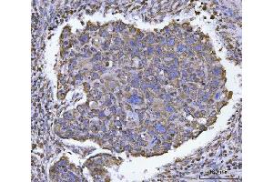 IHC analysis of ATP5F1B using anti-ATP5F1B antibody (ABIN7599866). (Atp5f1b (AA 123-529) anticorps)