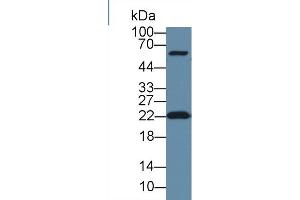 Western Blot; Sample: Human Hela cell lysate; Primary Ab: 1µg/ml Rabbit Anti-Human DTYMK Antibody Second Ab: 0. (DTYMK anticorps  (AA 43-190))