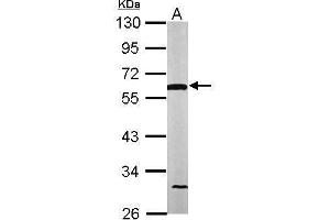 WB Image Sample (50 ug of whole cell lysate) A: Mouse brain 10% SDS PAGE antibody diluted at 1:1000 (DLD anticorps)