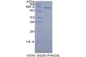 SDS-PAGE (SDS) image for Adiponectin Receptor 1 (ADIPOR1) (AA 1-136) protein (His tag,MBP tag) (ABIN2123758)