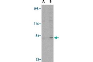 Western blot analysis of GPAM in rat brain tissue lysate with GPAM polyclonal antibody  at (A) 1 and (B) 2 ug/mL . (GPAM anticorps)