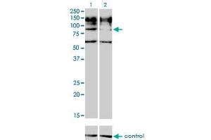 Western Blotting (WB) image for anti-Interleukin 31 Receptor A (IL31RA) (AA 21-121) antibody (ABIN599325) (IL31RA anticorps  (AA 21-121))