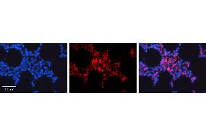 Rabbit Anti-CDC42 Antibody  AV Formalin Fixed Paraffin Embedded Tissue: Human Bone Marrow Tissue Observed Staining: Cytoplasm, Plasma membrane Primary Antibody Concentration: 1:100 Other Working Concentrations: 1:600 Secondary Antibody: Donkey anti-Rabbit-Cy3 Secondary Antibody Concentration: 1:200 Magnification: 20X Exposure Time: 0.