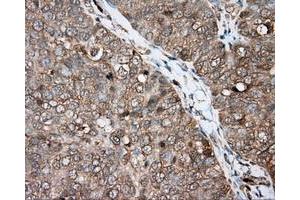 Immunohistochemistry (IHC) image for anti-Bruton Agammaglobulinemia tyrosine Kinase (BTK) antibody (ABIN1496973) (BTK anticorps)