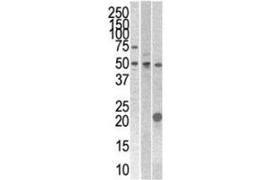 STYK1 antibody western blot analysis with 293, CEM, and mouse kidney cell line/tissue lysate (STYK1 anticorps  (AA 31-64))