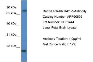 Western Blotting (WB) image for anti-Keratin Associated Protein 1-5 (KRTAP1-5) (C-Term) antibody (ABIN2788509) (KRTAP1-5 anticorps  (C-Term))