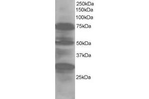 Western Blotting (WB) image for anti-LIM Domain 7 (LMO7) (Internal Region) antibody (ABIN2465906) (LMO7 anticorps  (Internal Region))