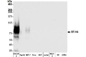 Western Blotting (WB) image for anti-V-Set Domain Containing T Cell Activation Inhibitor 1 (VTCN1) (AA 30-282) antibody (ABIN7454028)