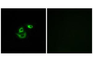 Immunofluorescence analysis of A549 cells, using CLCC1 antibody. (CLCC1 anticorps  (Internal Region))
