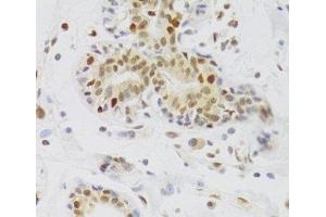 Immunohistochemistry of paraffin-embedded Human breast using NASP Polyclonal Antibody at dilution of 1:100 (40x lens). (NASP anticorps)
