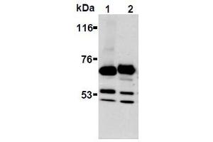 Western Blotting (WB) image for anti-Synaptotagmin I (SYT1) antibody (ABIN1109184) (SYT1 anticorps)