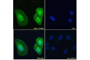 ABIN6391387 Immunofluorescence analysis of paraformaldehyde fixed U2OS cells, permeabilized with 0. (TIAM1 anticorps  (C-Term))