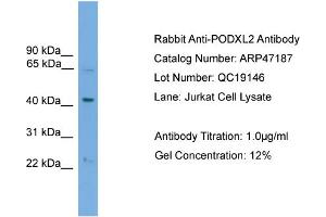 WB Suggested Anti-PODXL2  Antibody Titration: 0.