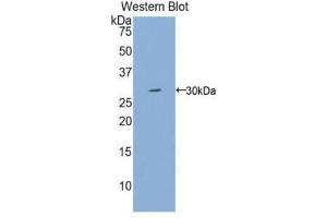 Western Blotting (WB) image for anti-Interleukin 2 Receptor, gamma (IL2RG) (AA 23-262) antibody (ABIN1174734) (IL2RG anticorps  (AA 23-262))