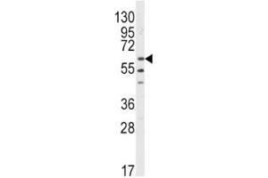 Western blot analysis of LYN antibody and HL-60 lysate.