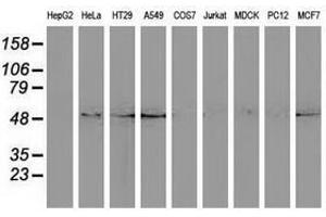 Image no. 1 for anti-Sequestosome 1 (SQSTM1) antibody (ABIN1499990) (SQSTM1 anticorps)