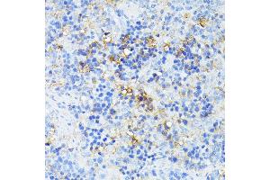 Immunohistochemistry of paraffin-embedded rat spleen using TP53I11 antibody (ABIN6131365, ABIN6149418, ABIN6149419 and ABIN6216636) at dilution of 1:100 (40x lens). (TP53I11 anticorps  (AA 1-70))